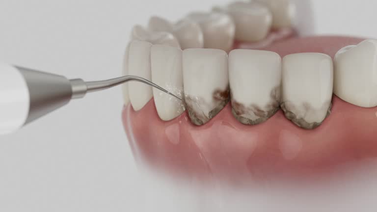 Trusted Root Canal Treatment service in Warsaw, IL - Dentist Open Now
